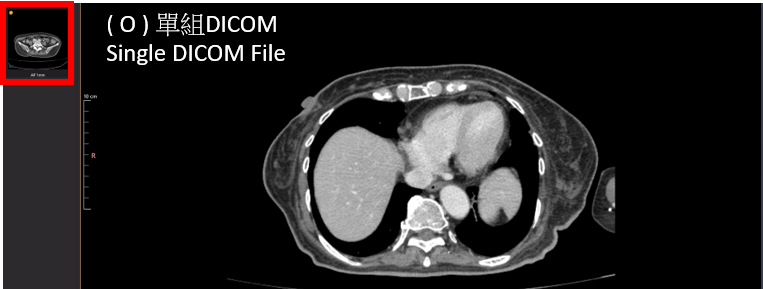 dicom
