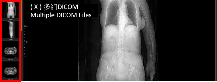 dicom
